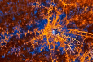 Photo Neuroscience